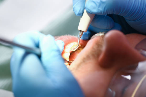 Best Emergency Denture Repair in East Wenatchee, WA